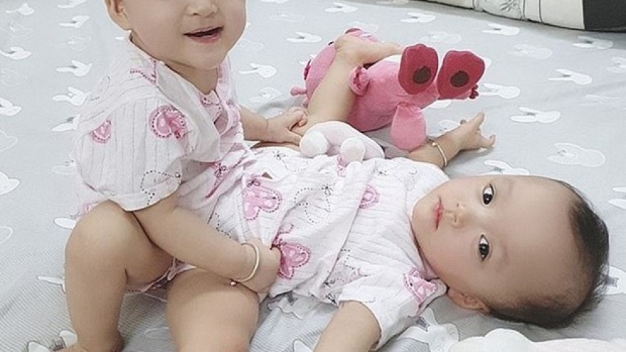 International press highlights operation to separate conjoined twins in Vietnam