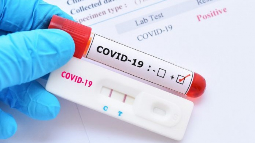 Các nước Đông Âu lập lại mốc kỷ lục số ca nhiễm mới Covid-19
