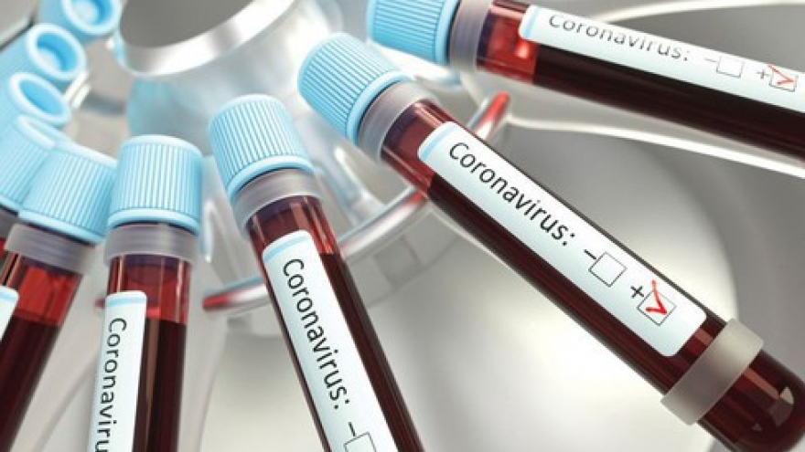 One more COVID-19 infection from Russia brings national tally to 382