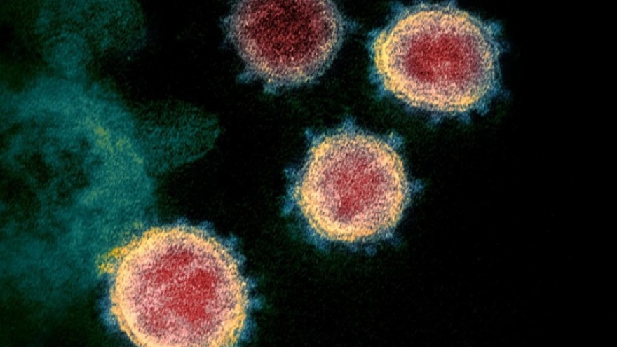Chủng virus SARS-CoV-2 gây Covid-19 tại Australia là loại dễ lây nhiễm