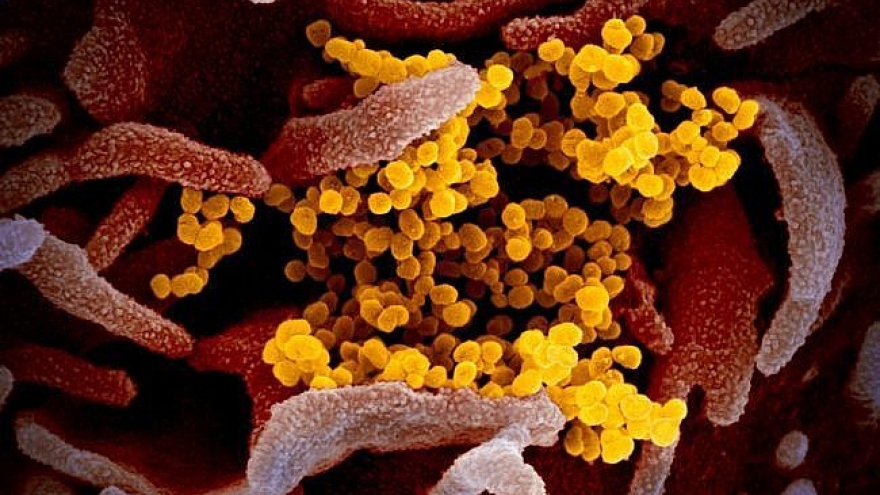 Nga phát triển thiết bị phát hiện virus SARS-CoV-2 trong không khí