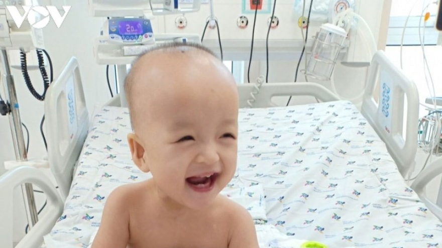 1 tháng sau mổ tách dính, chân Song Nhi đã khép được 1 nửa khung bột