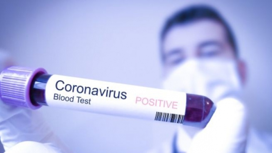Bệnh nhân tái dương tính với SARS-CoV-2 sau nửa tháng xuất viện