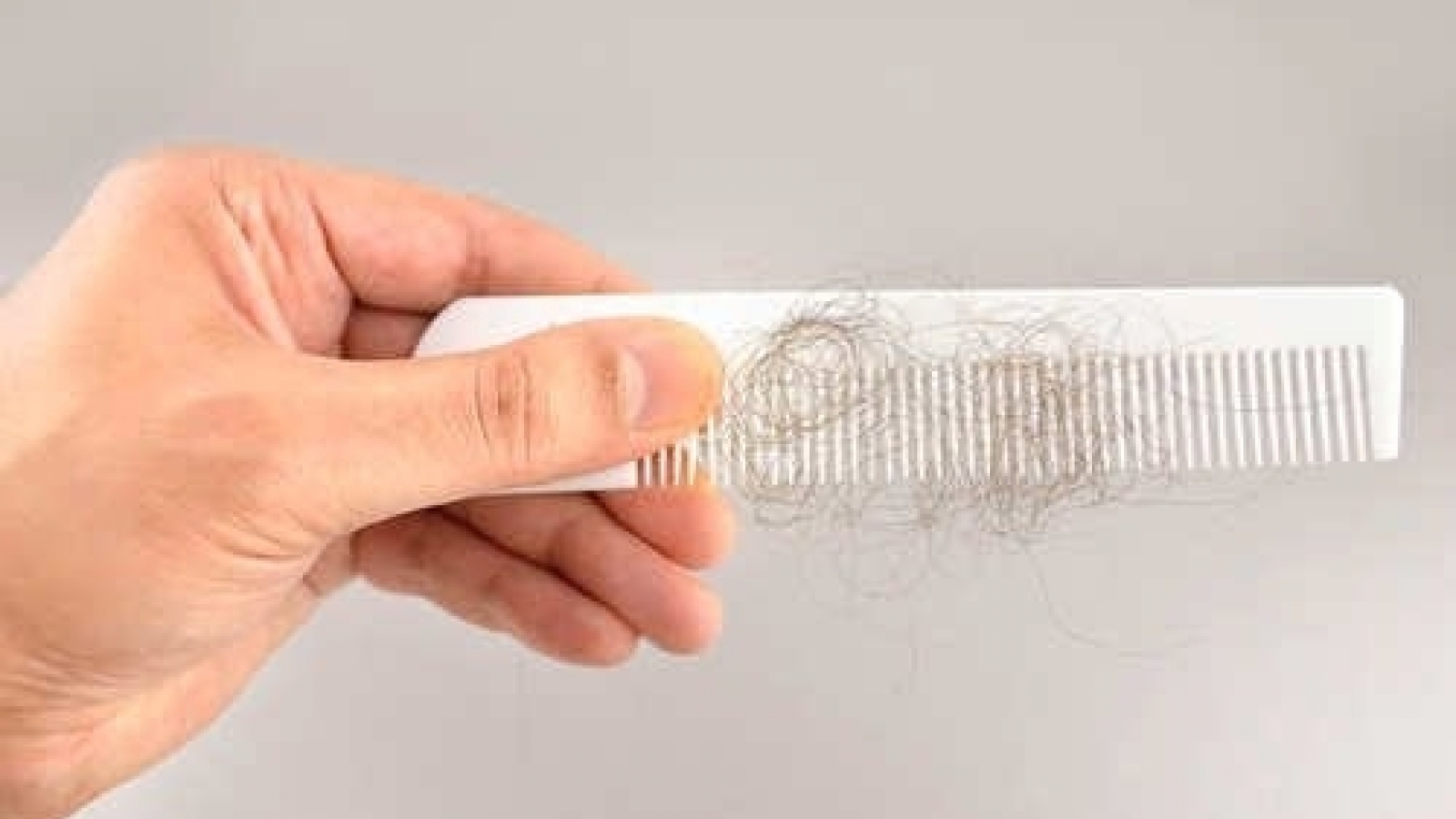 Nỗi ám ảnh rụng tóc và 5 thói quen cần từ bỏ