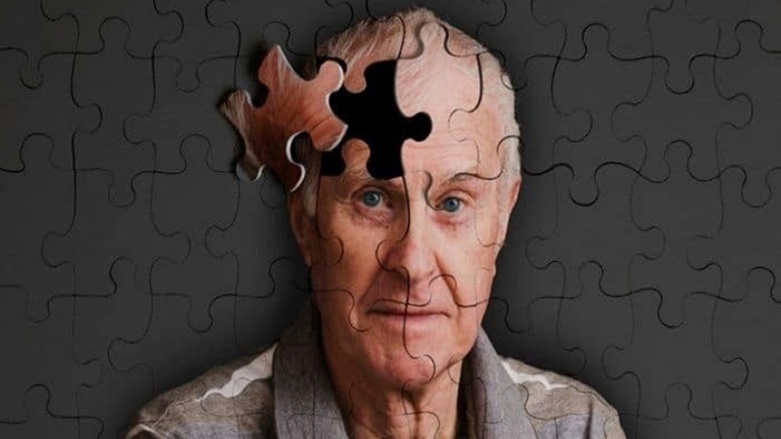 Alzheimer và những dấu hiệu sớm cần lưu ý