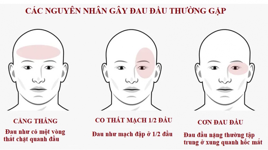 Làm gì khi bị đau đầu?