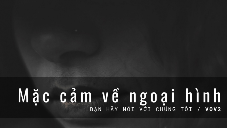 Mặc cảm về ngoại hình