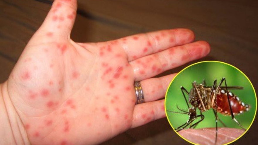 Hanoi still at high risk of dengue fever spread despite decline in cases