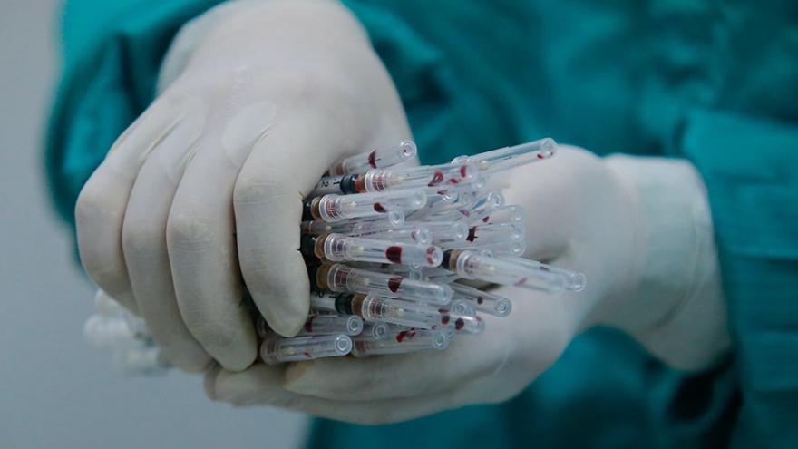 Việt Nam có nhiều tiềm năng để làm chủ công nghệ sản xuất vaccine Covid-19