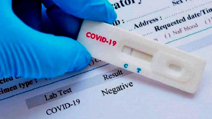 28 bệnh nhân có kết quả xét nghiệm âm tính với COVID-19 