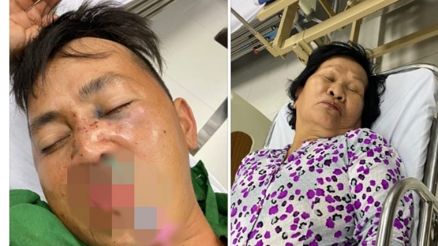 Khẩn trương điều tra vụ đánh “hội đồng” làm 2 người nhập viện tại Tiền Giang