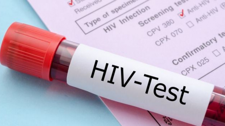 Thái Lan ngừng quy định xét nghiệm HIV/AIDS đối với người đi xin việc