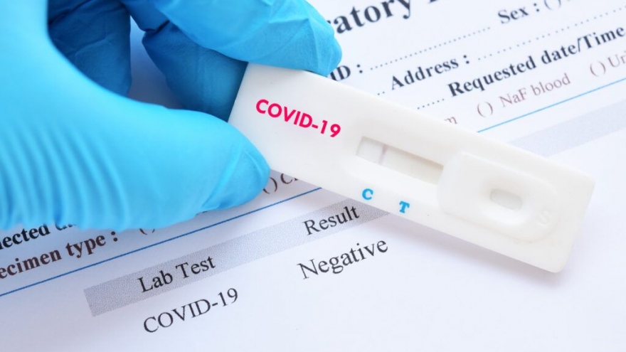 Slovakia là quốc gia đầu tiên phát triển thành công bộ xét nghiệm chủng mới virus ở Anh