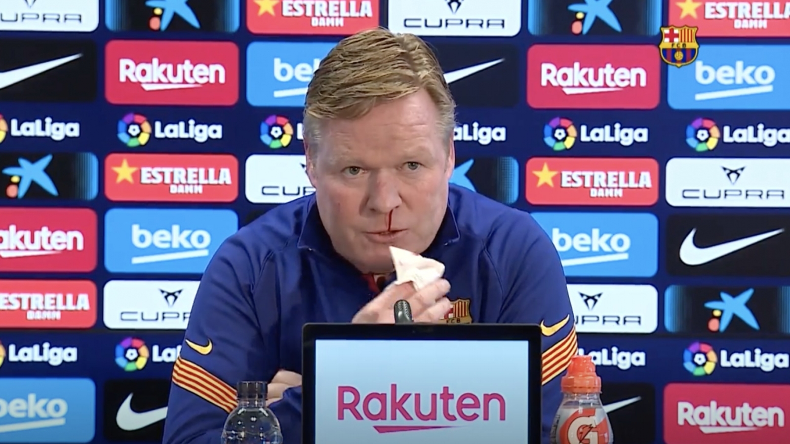 HLV Koeman bỏ dở buổi họp báo của Barca vì bị chảy máu mũi 