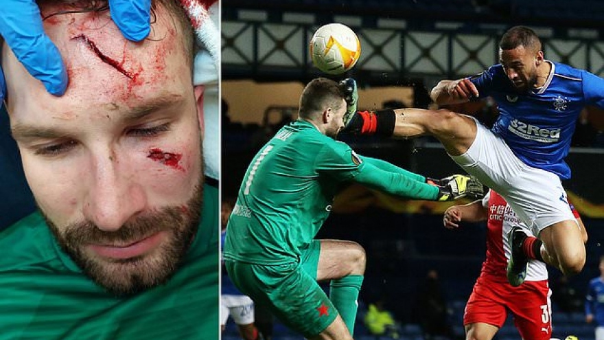 Thủ môn bị đạp thẳng vào mặt trong trận đấu bạo lực ở Europa League