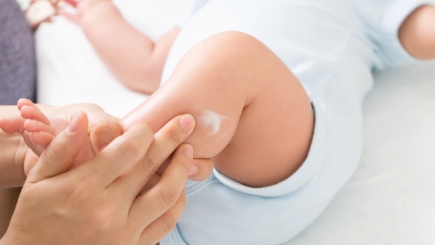 Cảnh báo dưỡng ẩm cho bé có thể làm tăng nguy cơ mắc chứng dị ứng