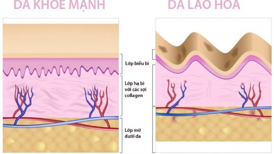 Biện pháp dễ thực hiện giúp làm chậm lão hóa da