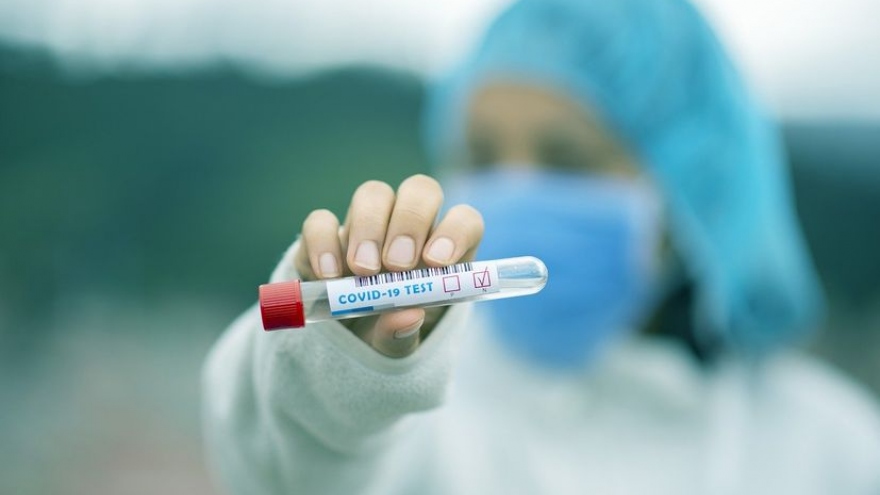 Nhằm tăng tỷ lệ tiêm vaccine, Croatia ra mắt xe buýt tiêm Covid-19