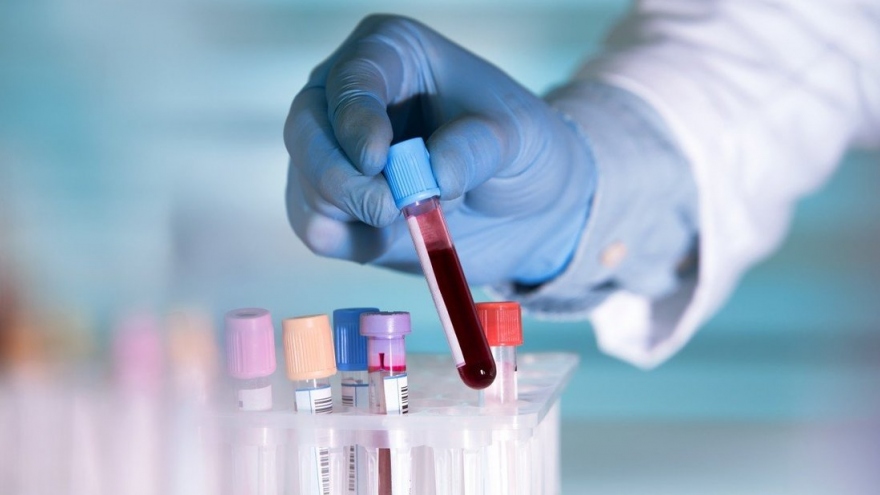 Trung Quốc xét nghiệm mẫu máu trước dịch Covid-19, truy tìm manh mối “bệnh nhân số 0”