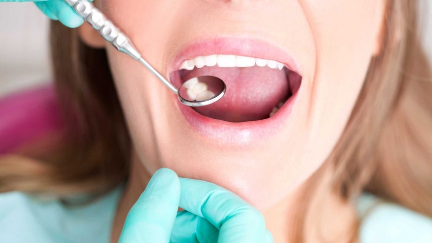 8 quy tắc cần ghi nhớ với răng nhạy cảm 