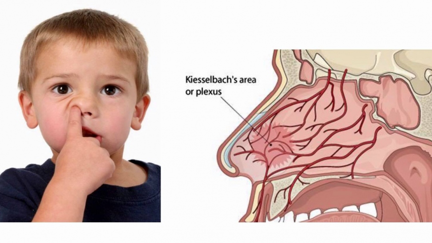 Trẻ em nên tránh những thói quen gì để phòng tránh viêm nhiễm vùng tai mũi họng?
