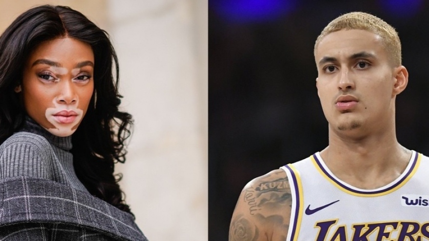 "Siêu mẫu bạch biến" Winnie Harlow chia tay bạn trai 