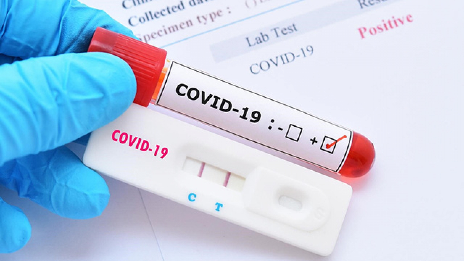 Bộ Y tế hướng dẫn xét nghiệm nhanh COVID-19 tại nhà
