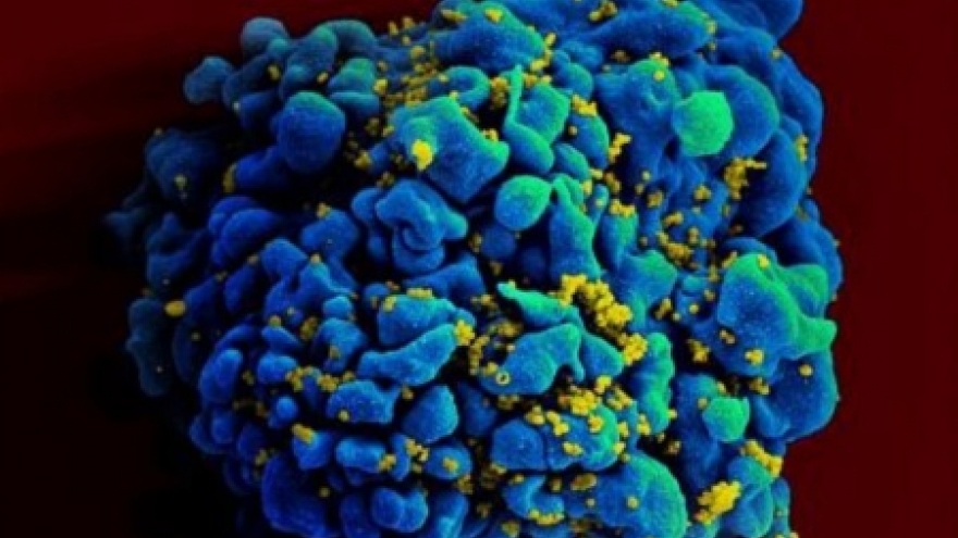 Thử nghiệm thành công vaccine HIV trên động vật