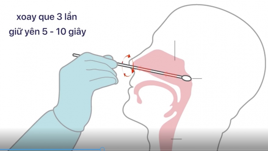 Hướng dẫn test nhanh Covid-19 tại nhà chuẩn theo Bộ Y tế