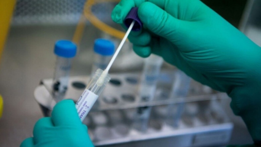 Test Covid dùng cho máy PCR được nhập khẩu với giá tối đa 150.000 đồng