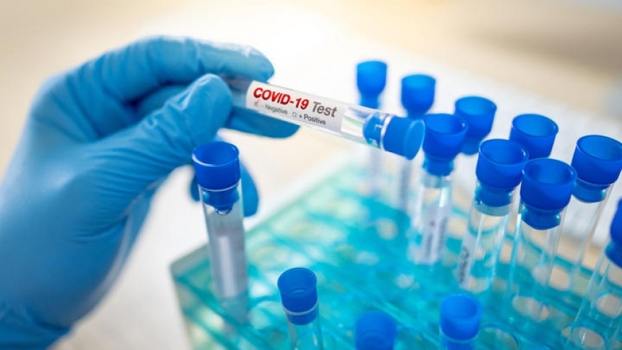 New Zealand ghi nhận số ca mắc Covid-19 cao nhất kể từ đầu đại dịch