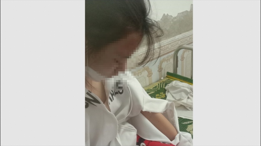 Đi mua kim khâu, nữ sinh ở Hà Tĩnh bị hành hung "chấn động não"