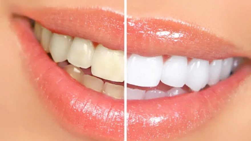 10 quy tắc để có hàm răng trắng bóng và chắc khỏe