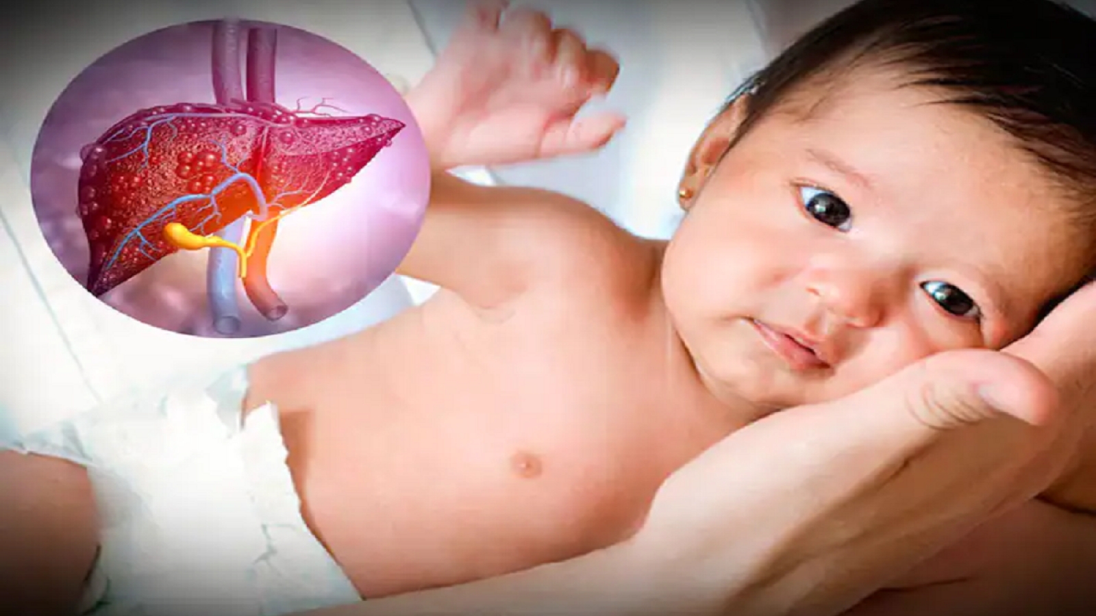 Virus bí ẩn gây viêm gan ở trẻ em tiếp tục lan ra nhiều quốc gia