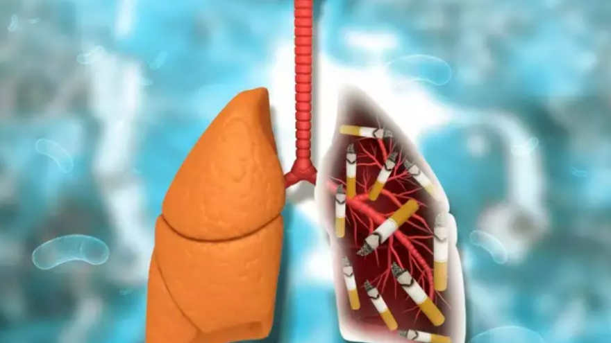 Thực phẩm có thể "cứu" người hút thuốc khỏi tổn thương phổi