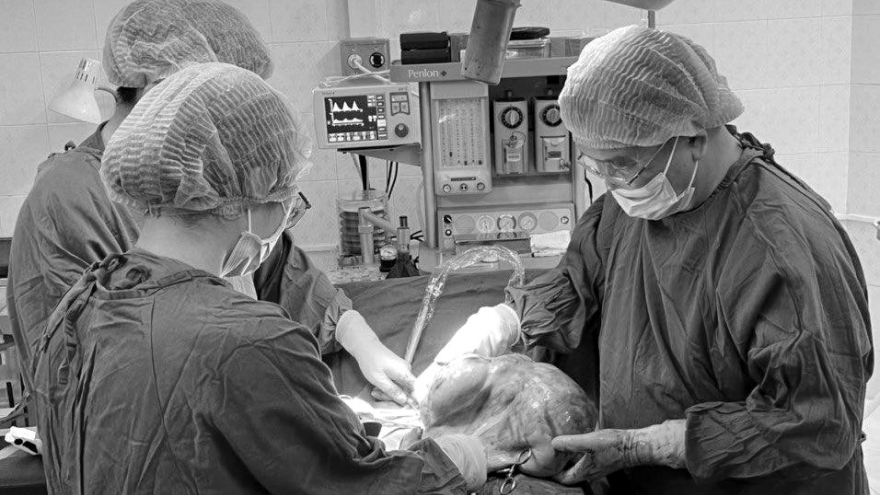 Bệnh viện tuyến huyện cắt thành công khối u buồng trứng nặng 10kg