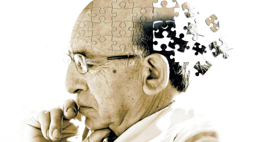 Dấu hiệu và triệu chứng của bệnh Alzheimer đừng bỏ qua