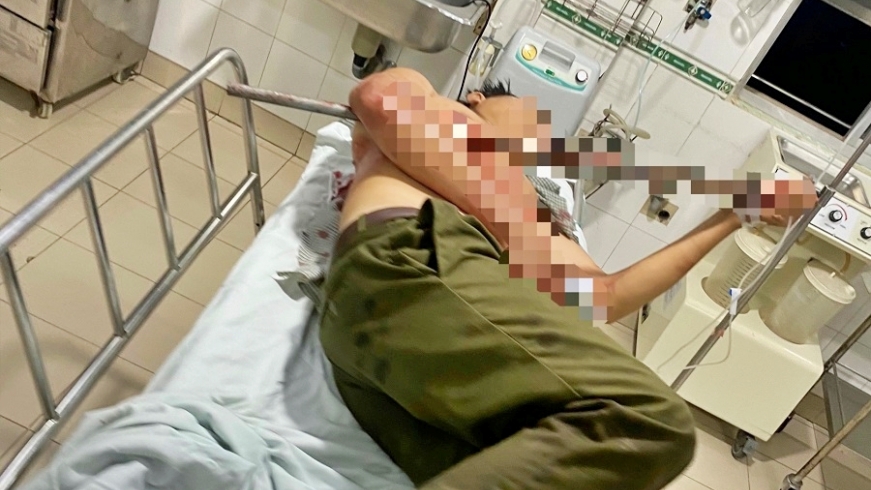 Ngăn chặn nhóm thanh niên hỗn chiến, tổ trưởng tổ dân phòng bị đâm