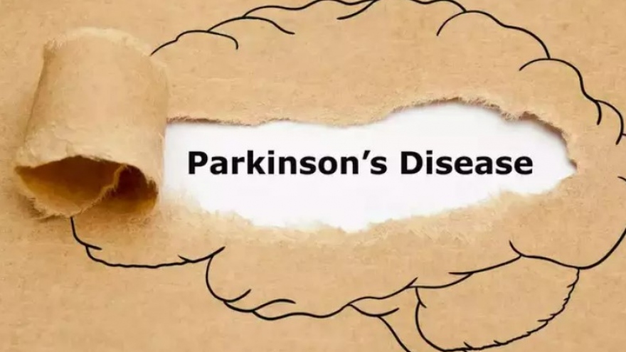 Đừng bỏ qua các dấu hiệu cảnh báo sớm của bệnh Parkinson