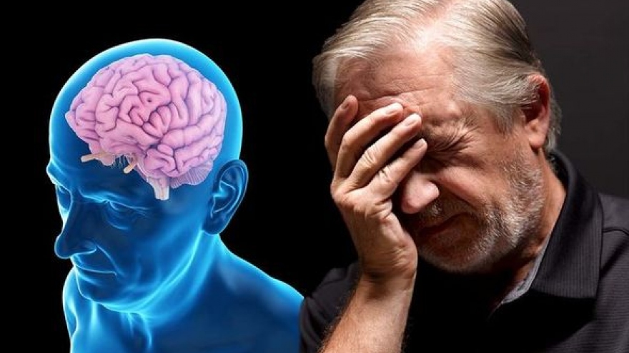 Thói quen không ngờ dẫn đến bệnh Alzheimer