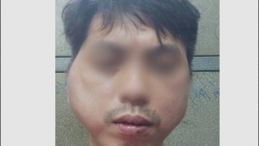 Khởi tố vụ án đánh đập, hành hung nhân viên quán lẩu nướng ở Hà Nội