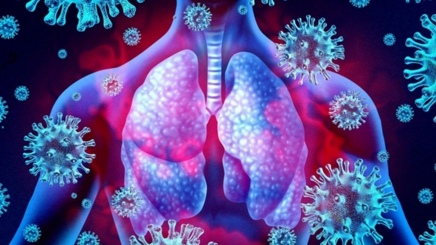 Viêm phổi ở người cao tuổi - nguyên nhân và cách phòng bệnh