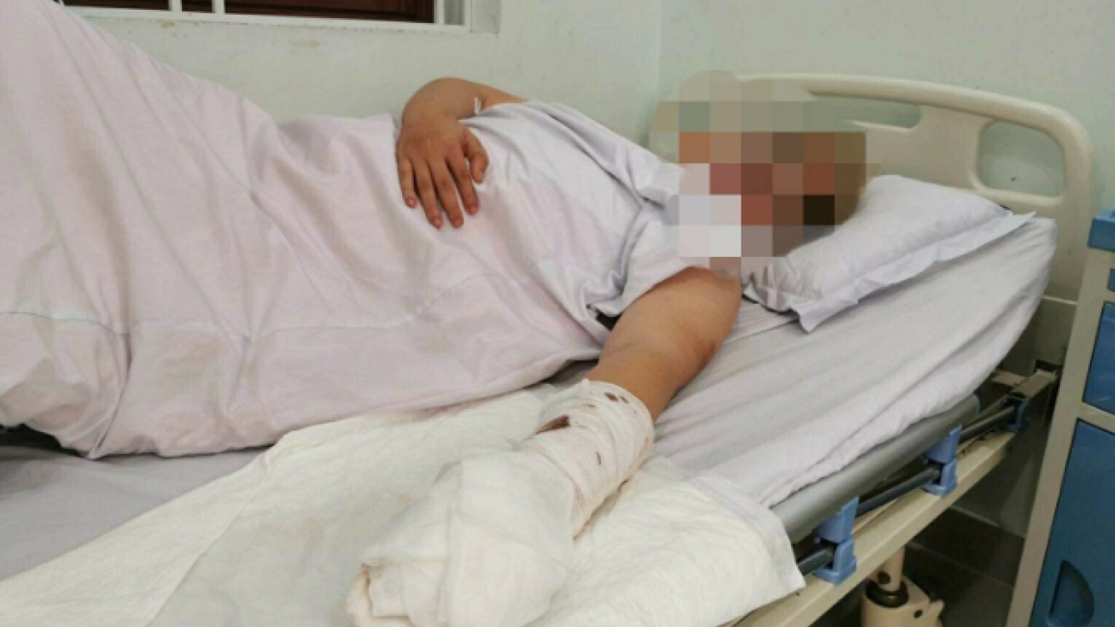 Nam thanh niên bị chém cụt 2 ngón tay tại sân bóng