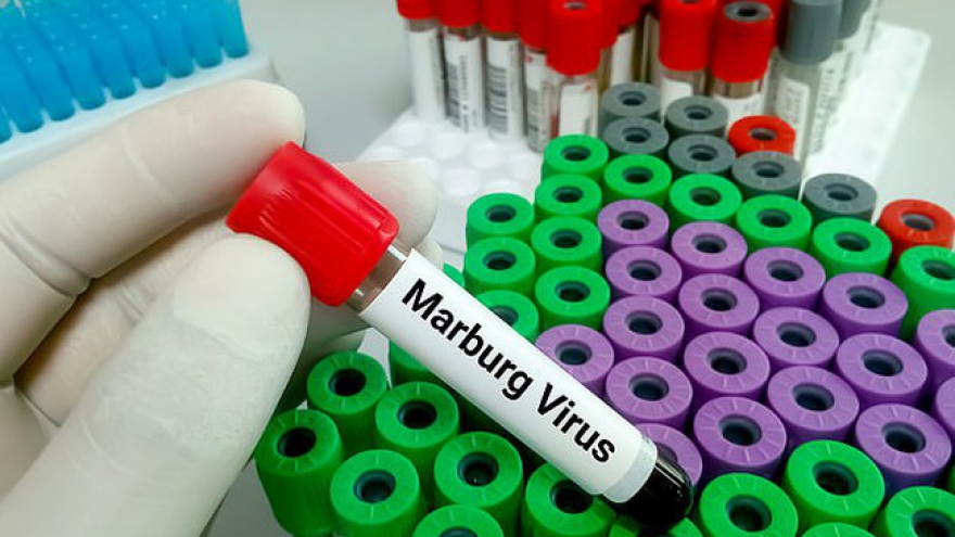 Cảnh giác cao với bệnh do virus Marburg