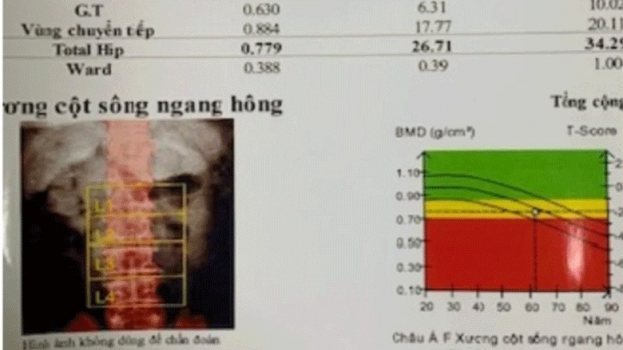 Tự ý mua thuốc điều trị, bác sĩ chỉ ra hậu quả khôn lường