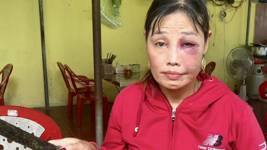 Không đưa khay gia vị, bà chủ quán mì ở Bà Rịa - Vũng Tàu bị đánh tím mặt