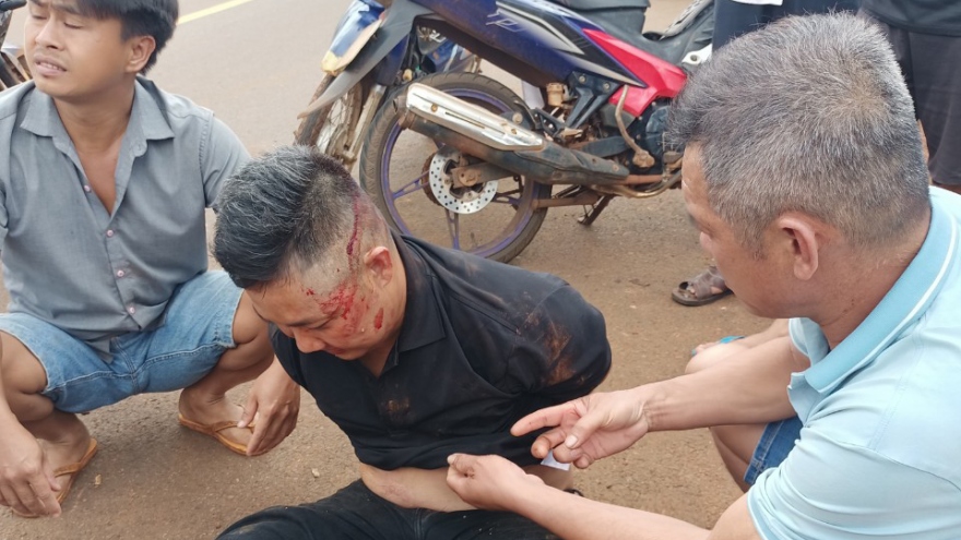 Dùng súng giải quyết mâu thuẫn, 3 người đàn ông ở Bình Phước bị thương