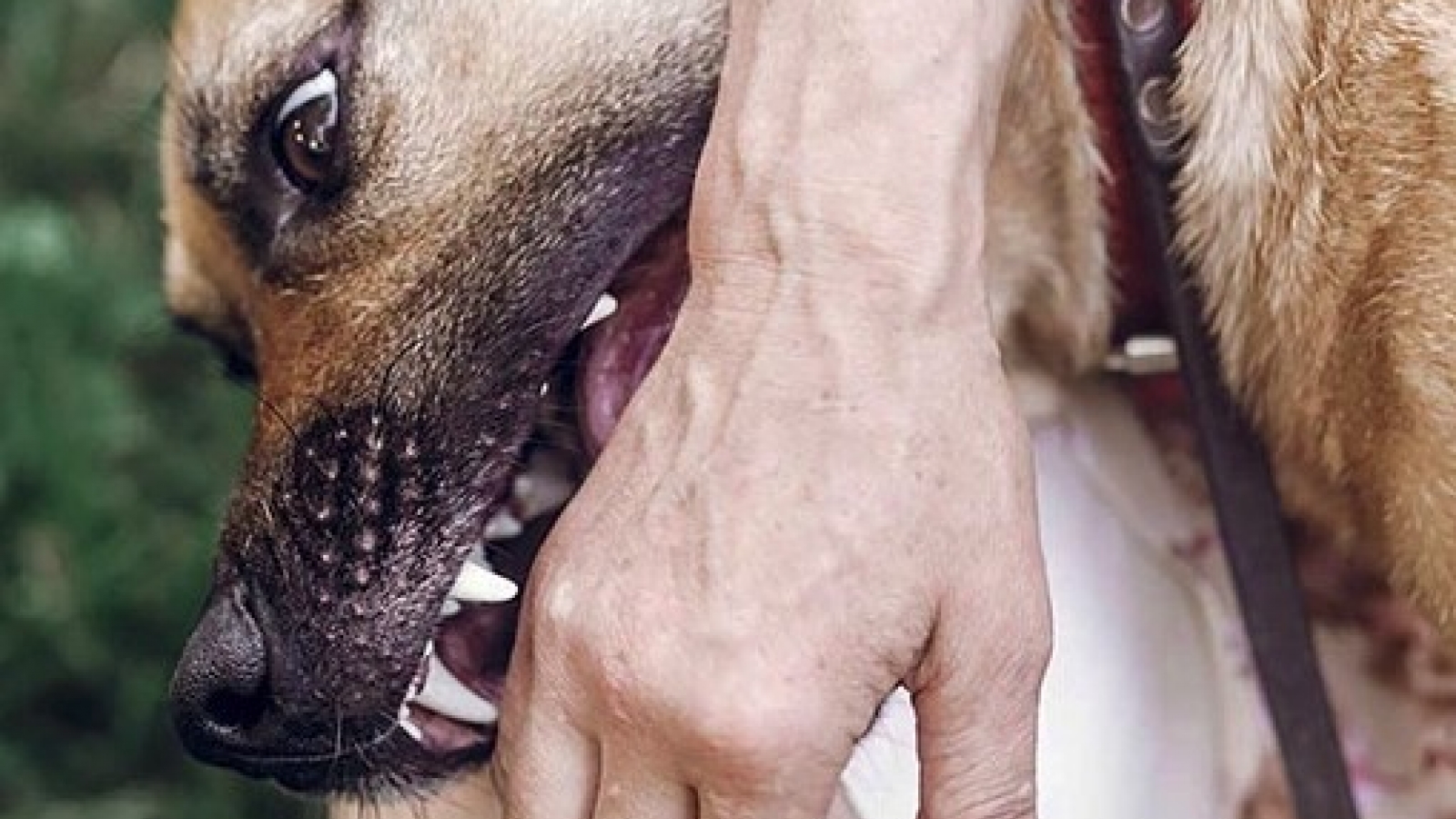 Rabies claims 75 human lives in Vietnam every year