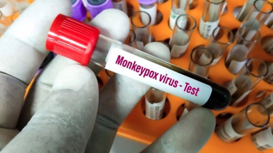 Southern Bien Hoa city logs second monkeypox infection