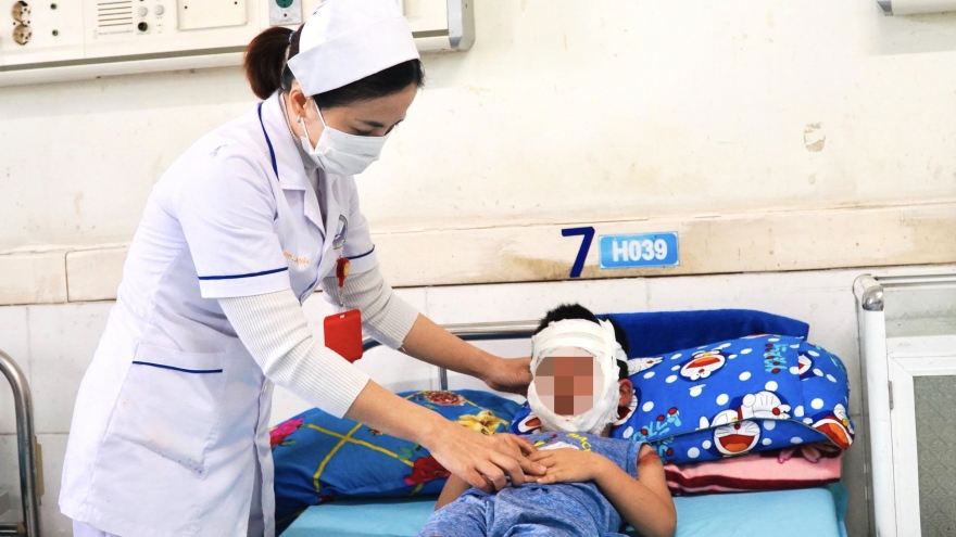 Bé trai 4 tuổi bị bỏng toàn mặt do bóng bay phát nổ
